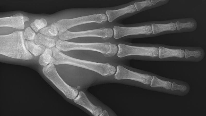 Photo: Mikael Häggström