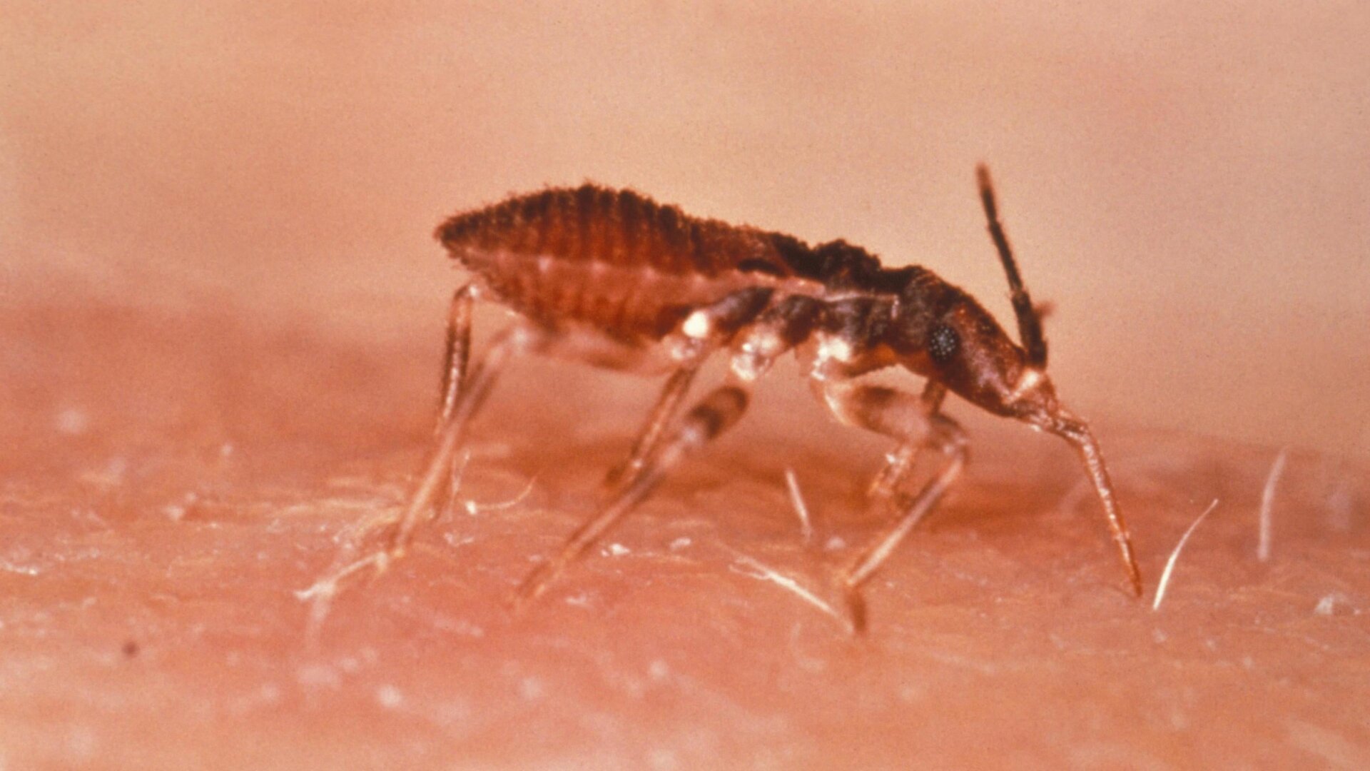 Photo: CDC/World Health Organization