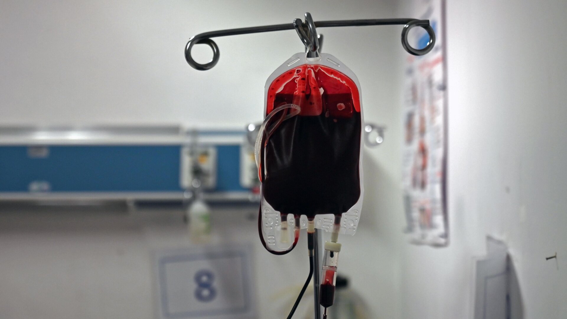 A blood bag being used to transfuse blood to a patient.