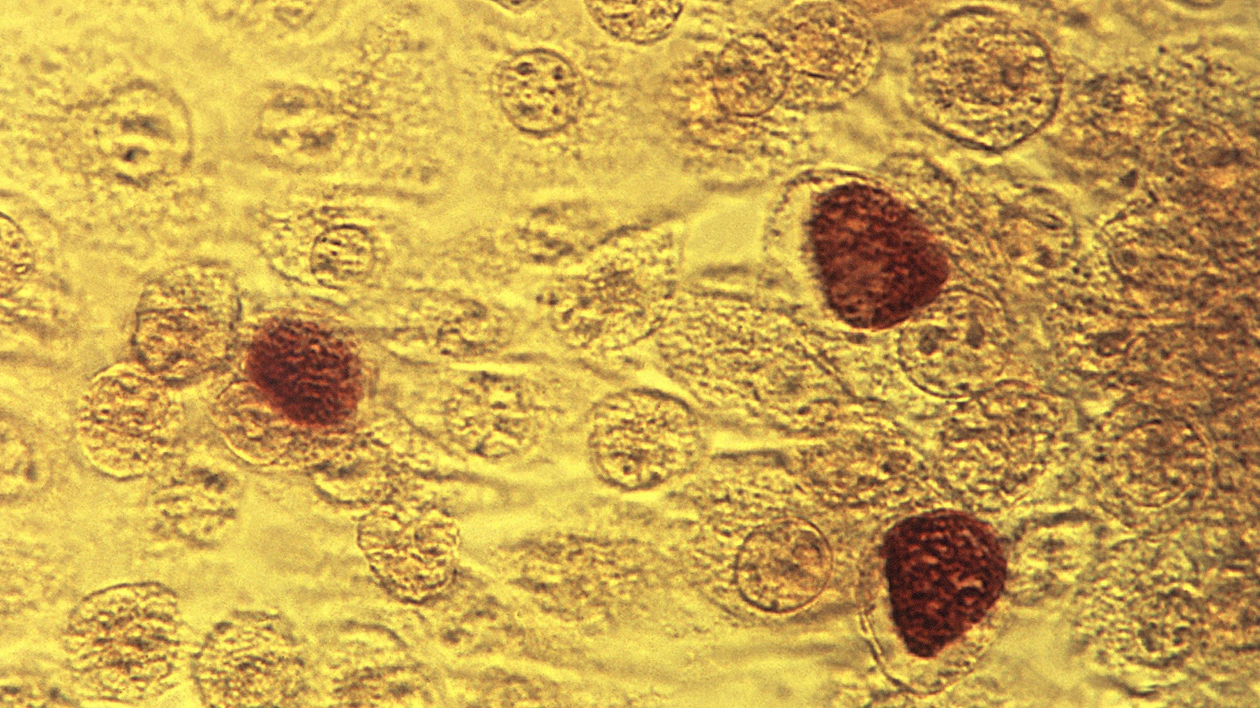 Chlamydia trachomatis.