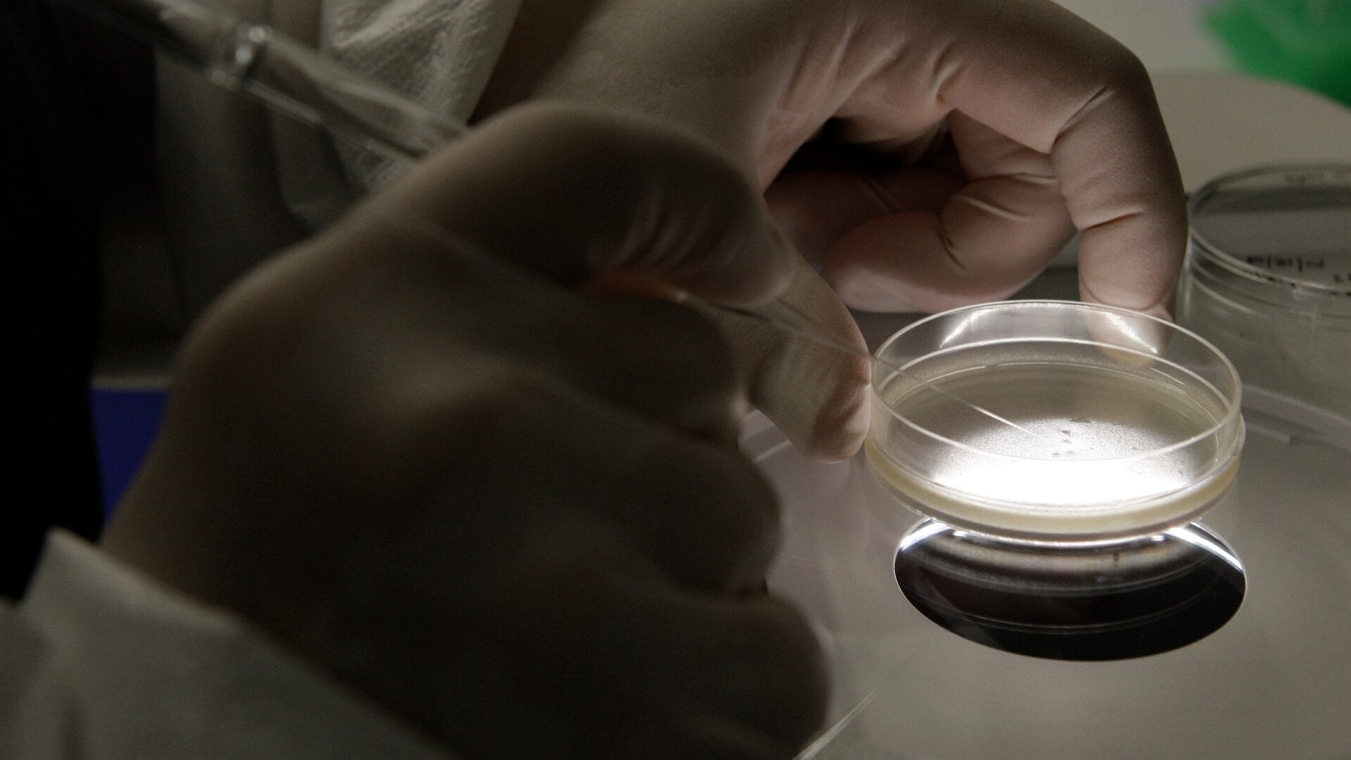 A petri dish containing embryonic human stem cells.
