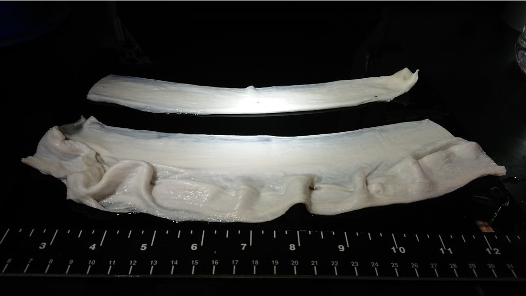 Spun gelatin microfibers.