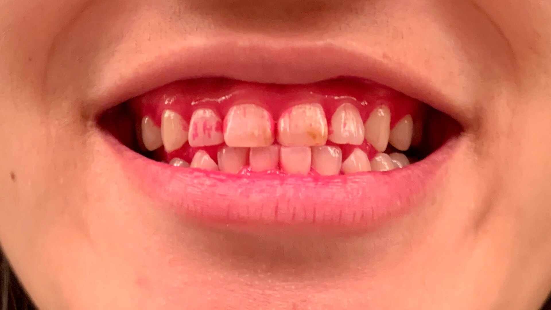 Happy Halloween! Enjoy this cursed teef tablet photo. It was not my idea but I’ll do anything for the blog. 