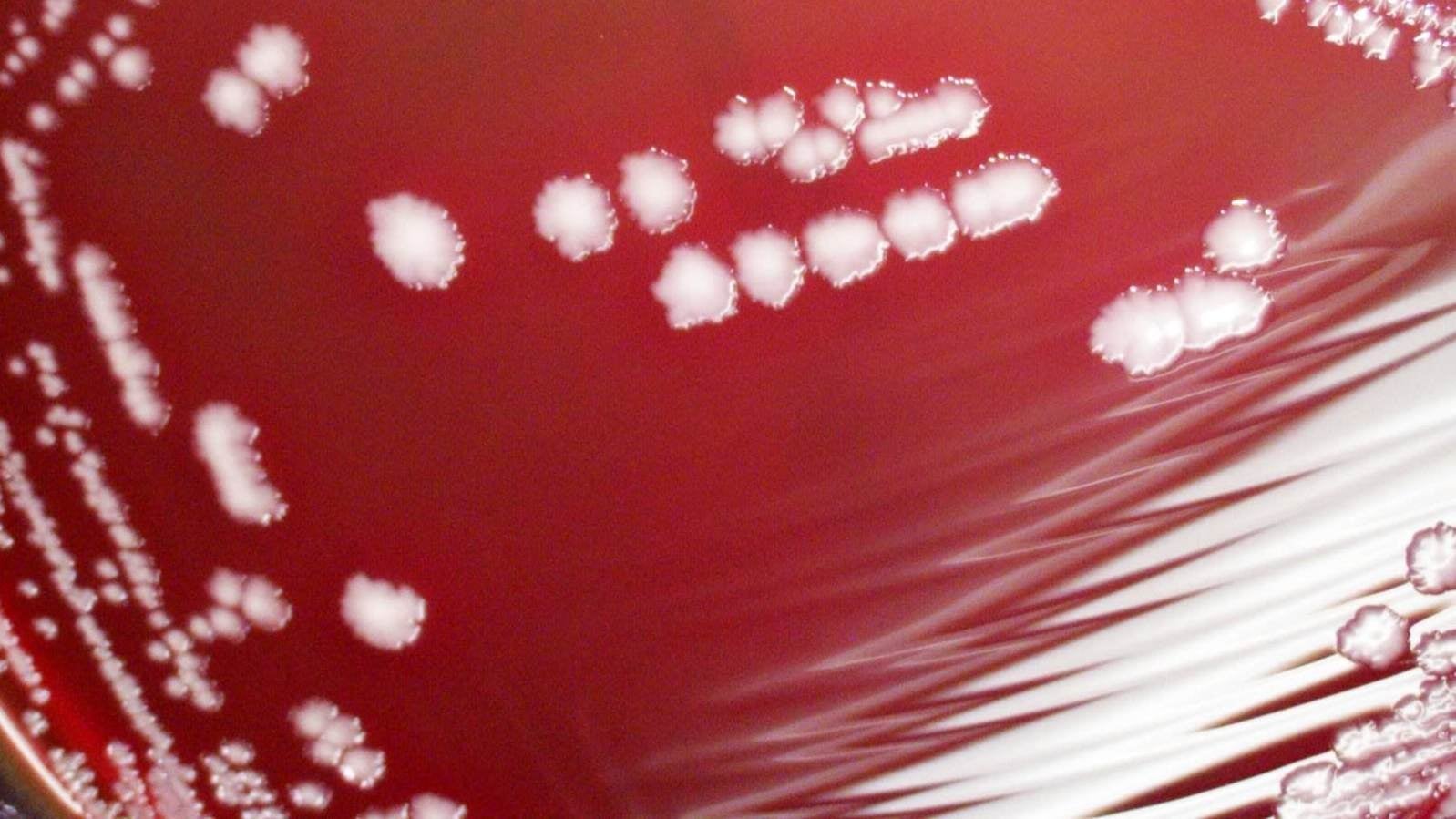 Yersinia pestis being grown in a petri dish.