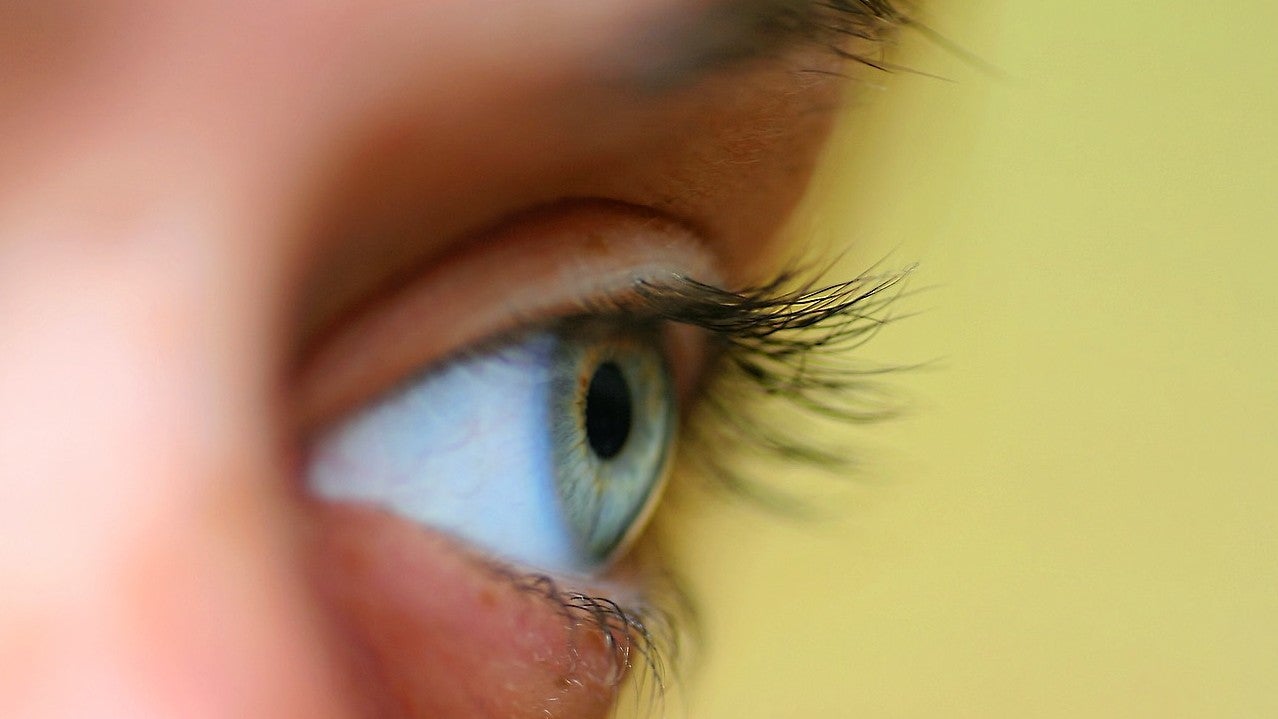 This is not the actual eye of the woman who got eye worms.