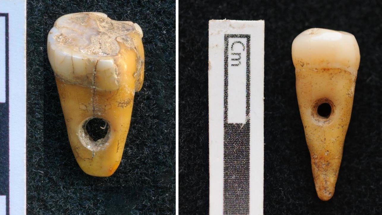 8,500-year-old human teeth with holes drilled into them.