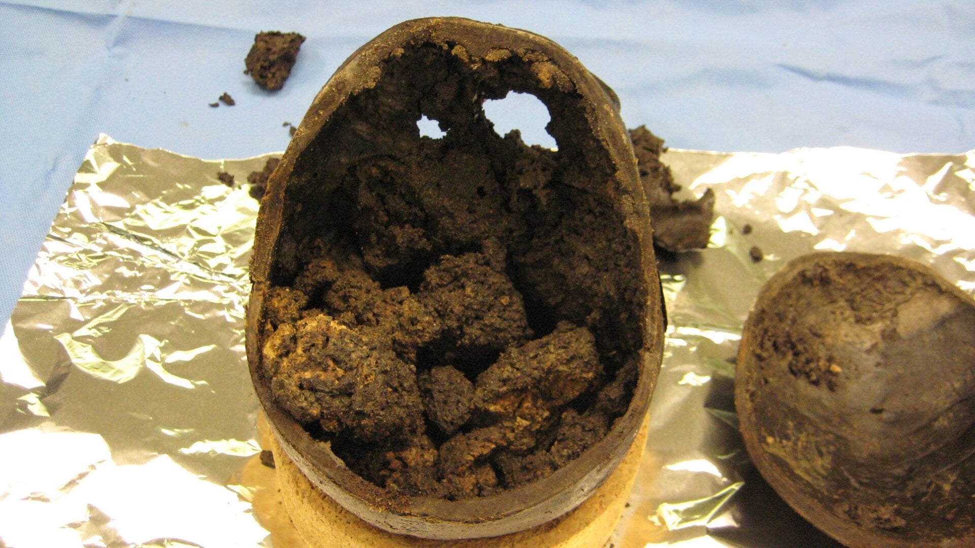 Bits of well-preserved brain found in the Iron Age skull.