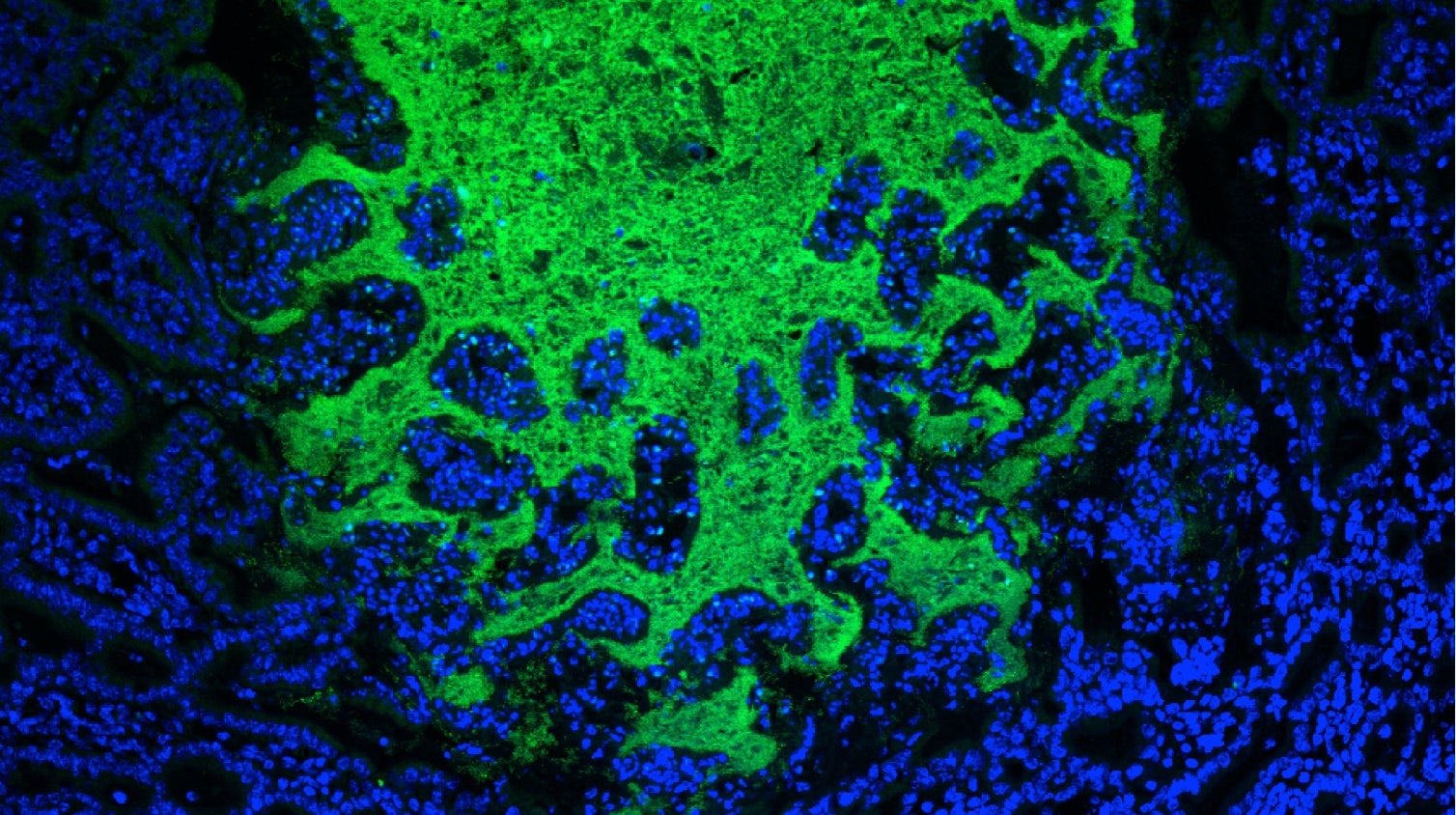 Gut bacteria, made fluorescent, in a mouse’s small intestine.