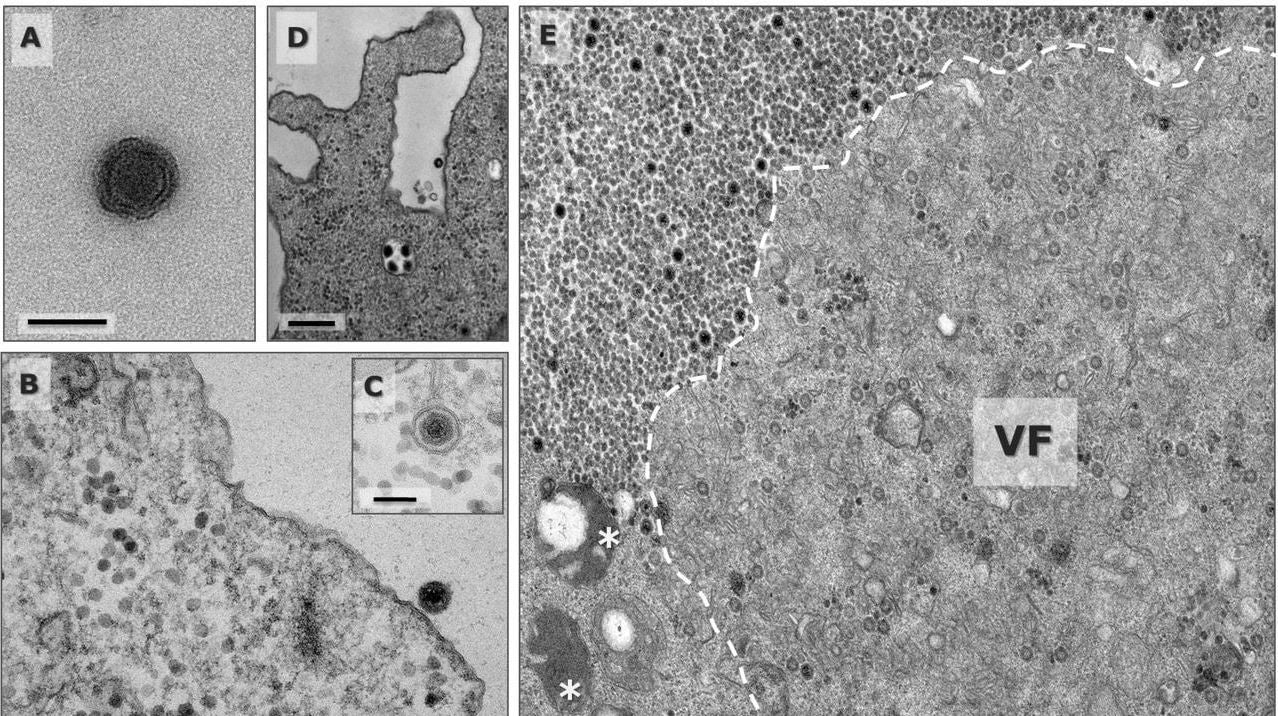 Various images of Yaravirus under an electron microscope
