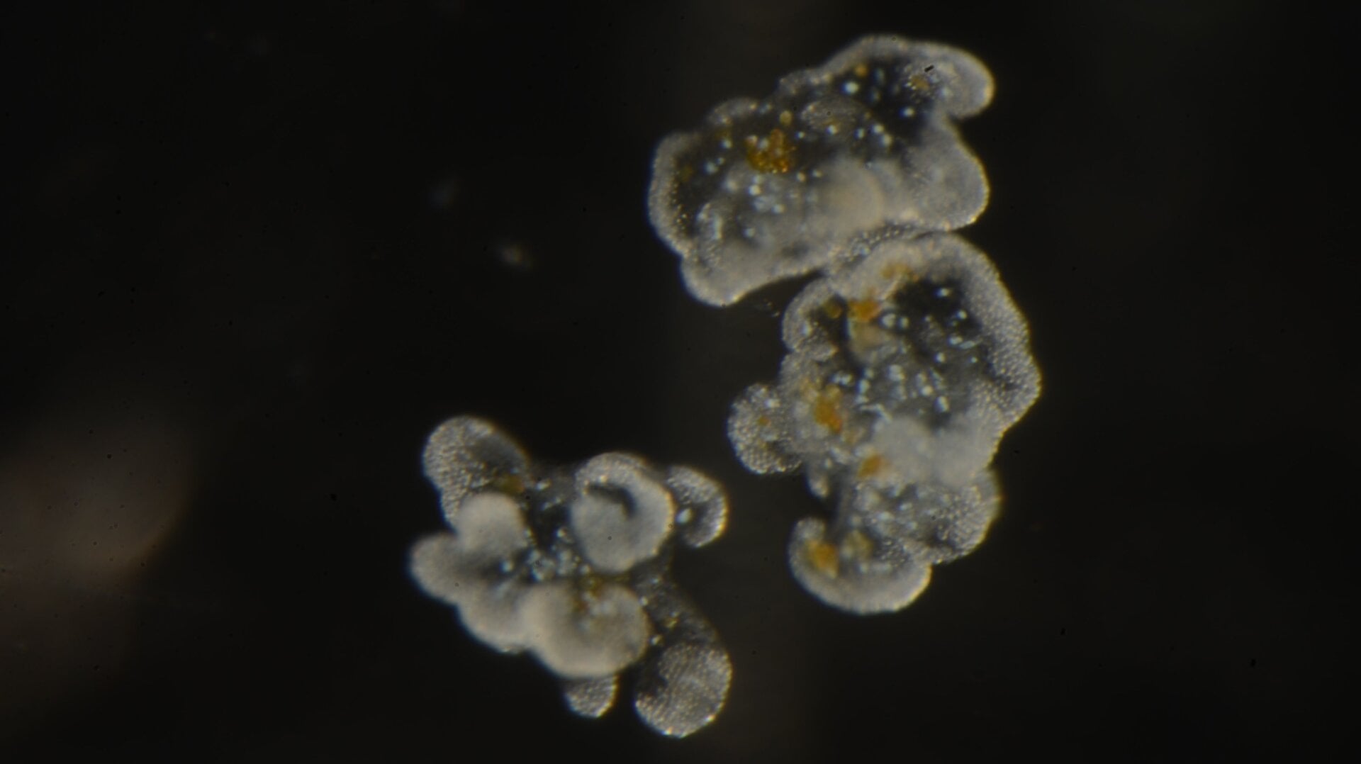 Cassisomes as seen through a microscope. The oval structures are laced with toxic capsules known as nematocysts, and the brown blobs are symbiotic algae that live within the tissues of Cassiopea.