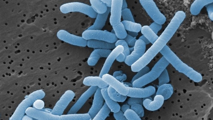 The rod-shaped Lactobacillus paracasei, seen above, is one of the 300 or so species of bacteria that commonly resides in the human vagina.