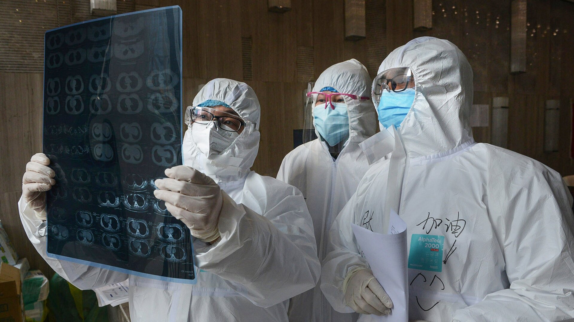 Chinese doctors in Yunmeng county, Xiaogan city, in the coronavirus outbreak epicenter of Hubei province viewing the results of a lung CT scan in a suspected case.