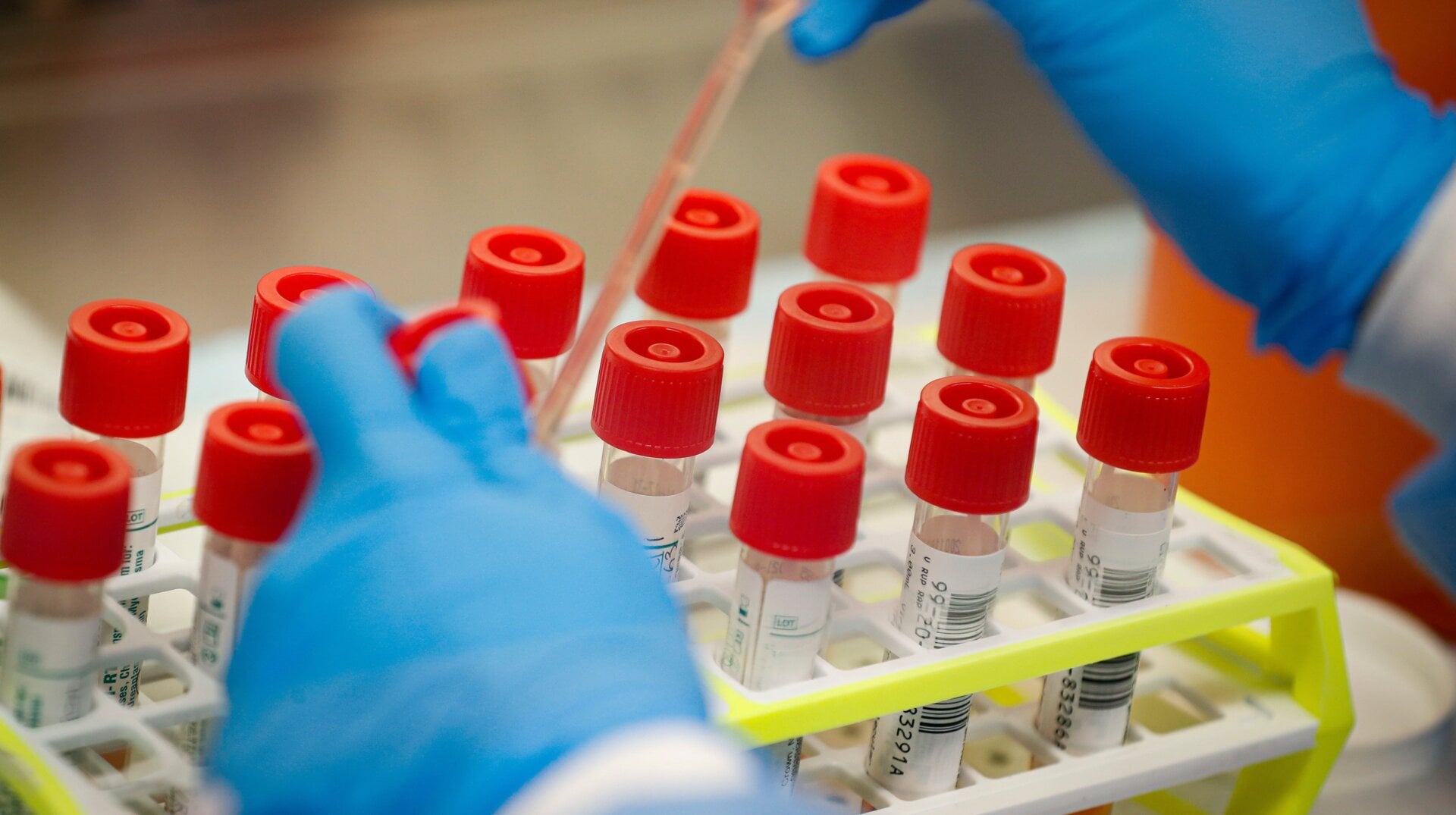 Covid-19 patient samples being prepared for testing at Northwell Health Labs in Lake Success, New York.