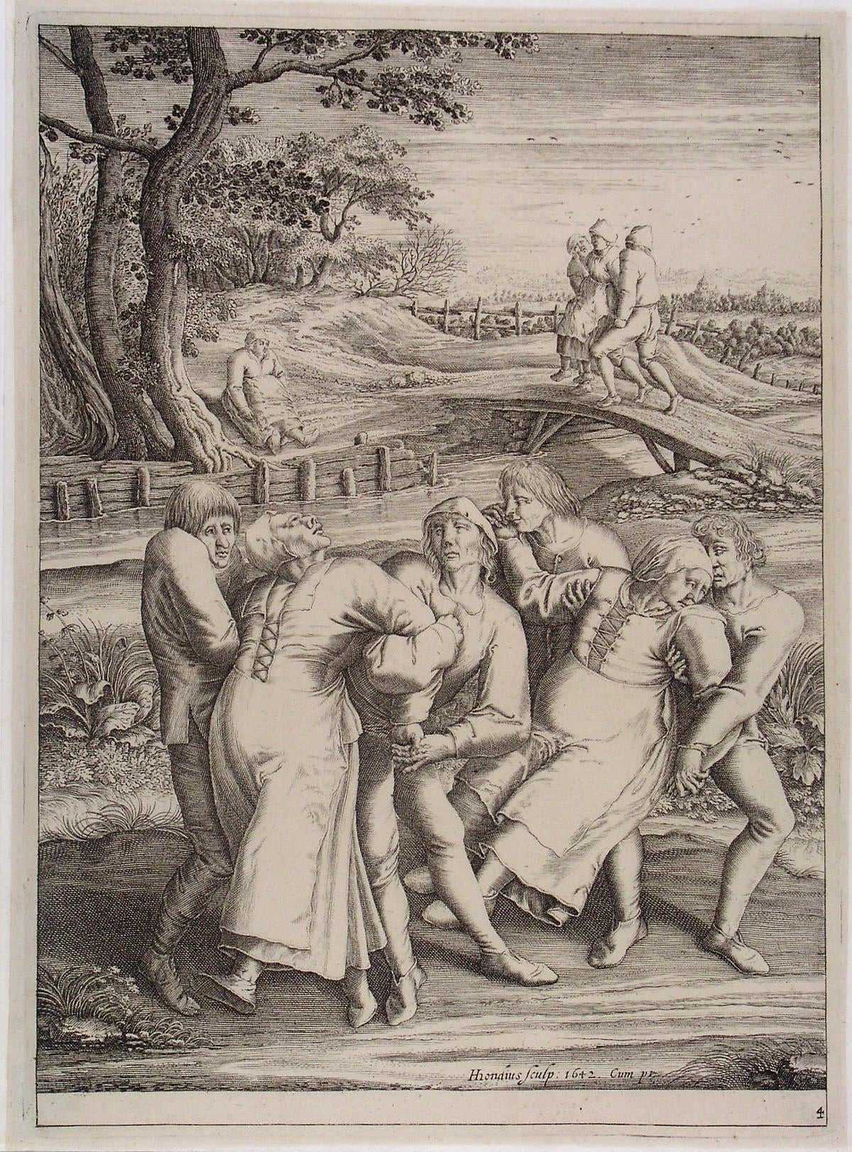 A 1642 engraving by Hendrik Hondius, based on Peter Breughel’s 1564 drawing depicting sufferers of a dance epidemic occurring in Molenbeek, Belgium.