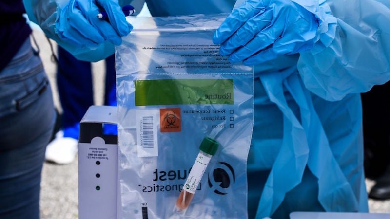 The World Health Organization announced on Friday that there is currently no evidence that people who have recovered from covid-19 cannot be reinfected.
