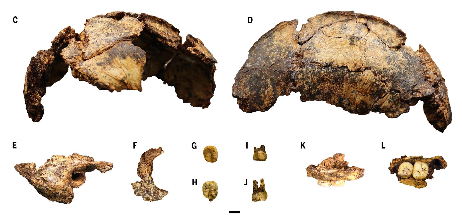Views of DNH 152, the Paranthropus cranial fragment, along with recovered dental remains. 