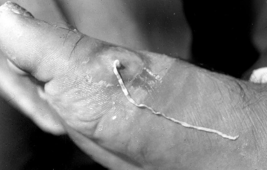 Photo: National Museum of Health & Medicine