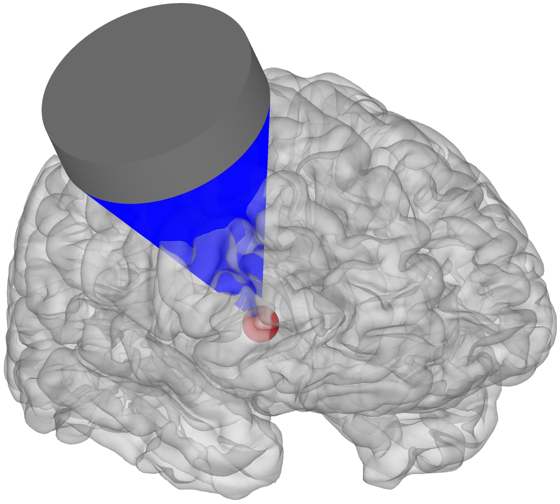 Graphical representation of the targeted brain stimulation with ultrasound.