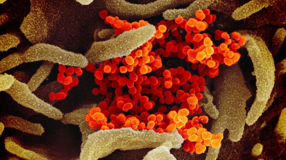 SARS-CoV-2 (shown in orange) as seen through a scanning electron microscope.