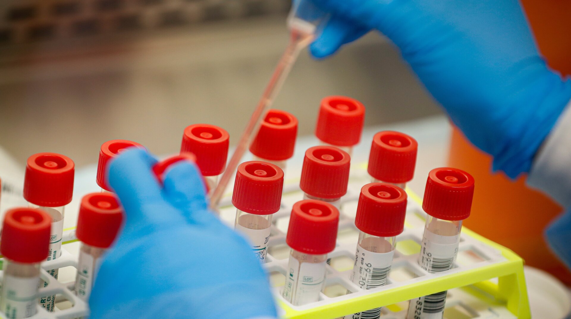 A lab technician prepares covid-19 patient samples for testing.