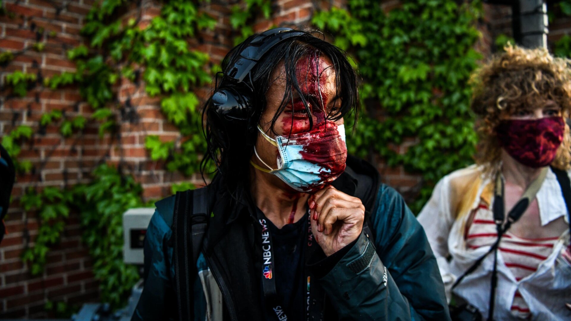 A journalist is seen bleeding after police started firing tear gas and rubber bullets near the 5th police precinct following a demonstration to call for justice for George Floyd, a black man who died while in custody of the Minneapolis police, on May 30, 2020 in Minneapolis, Minnesota.