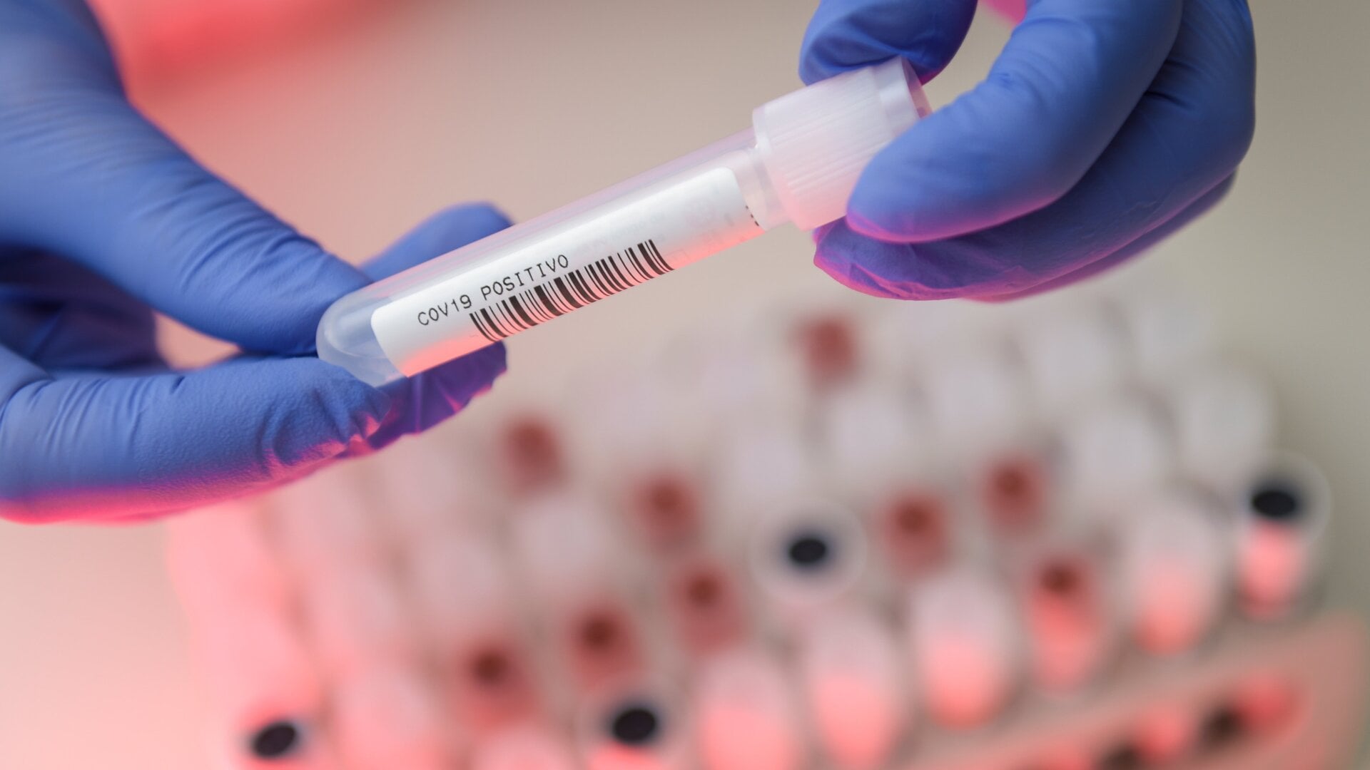 A lab worker handling a positive covid-19 sample at the Hermes Pardini Lab in Brazil.