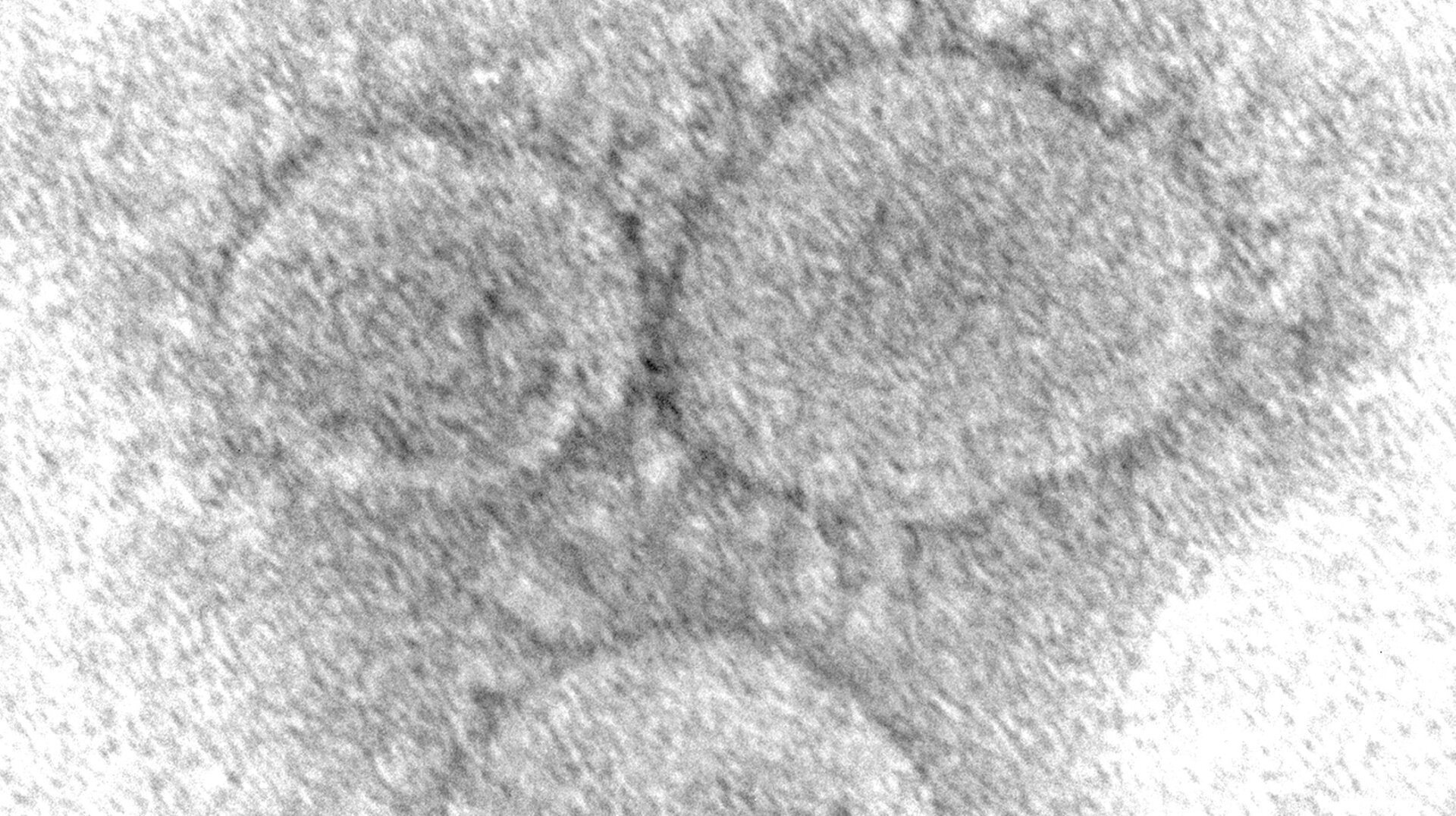 An electron microscopic image of SARS-CoV-2, the virus that causes covid-19
