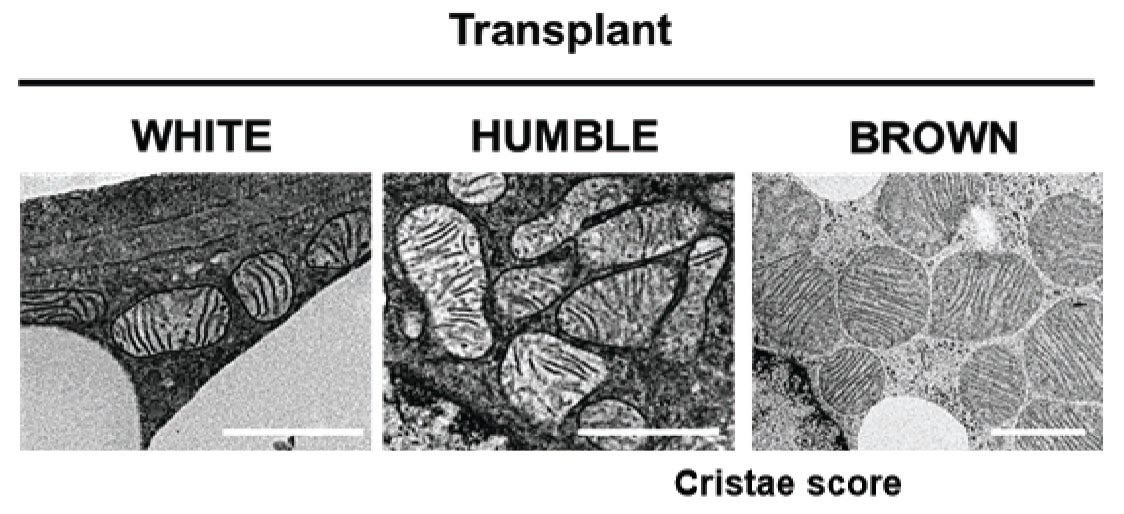 Above, the mitochondria of white, HUMBLE, and brown fat cells, as seen in Tseng and her team’s experiments with mice.