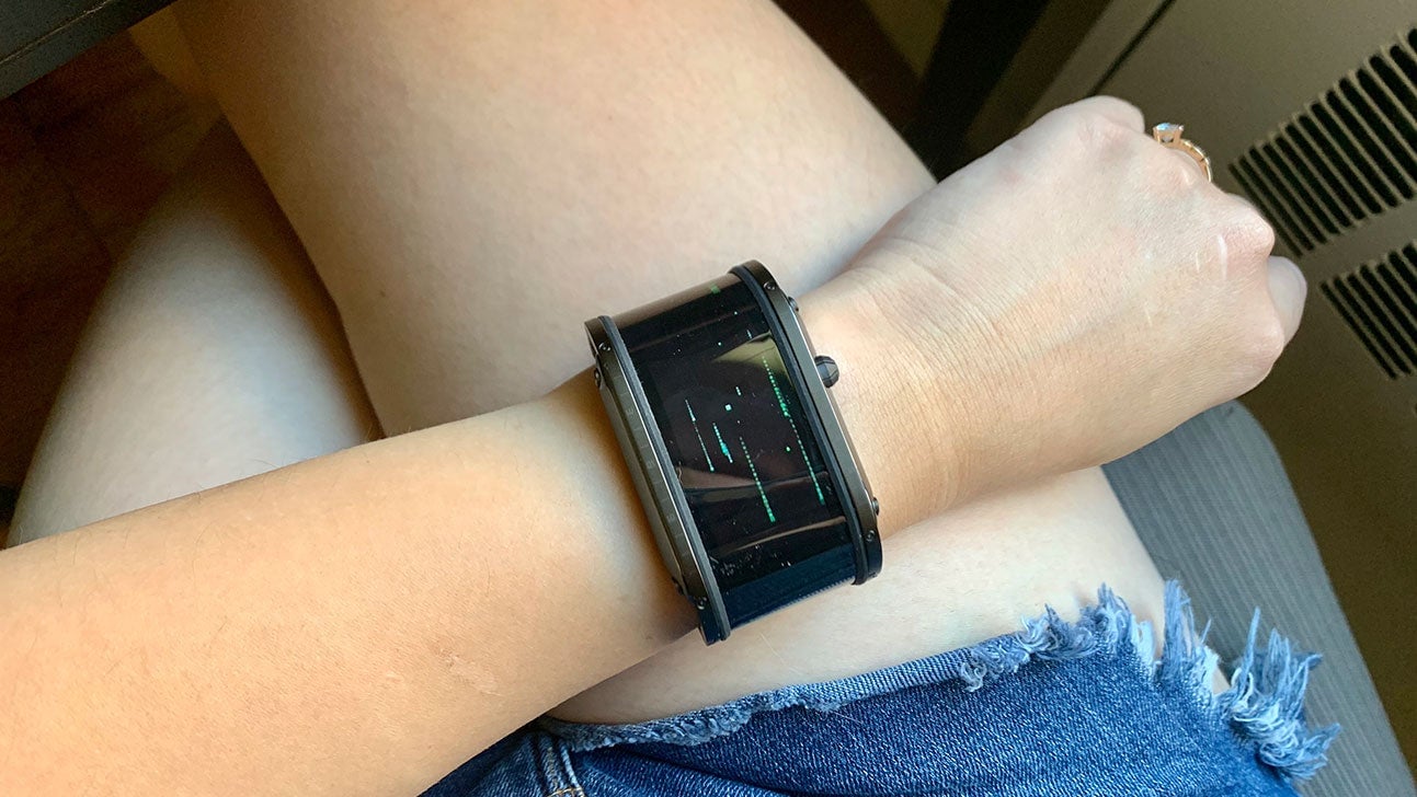 Never mind the obvious farmer’s tan! This watch is huge!