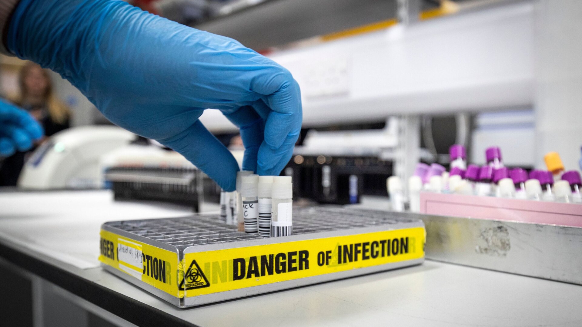 A lab technician extracting viruses from swab samples in the coronavirus testing laboratory at the Glasgow Royal Infirmary in Scotland, taken February 19, 2020.