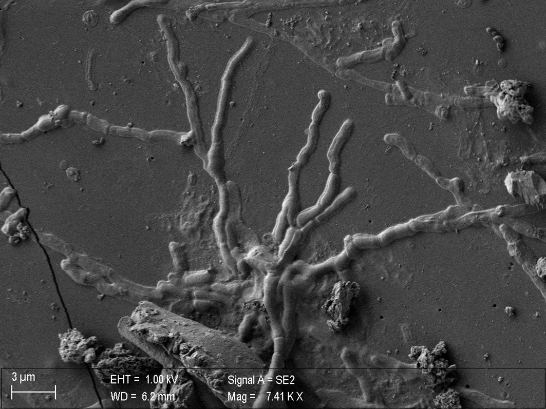 A scanning electron microscope image showing what appears to be worm-like axons sticking out from neuronal cells. 