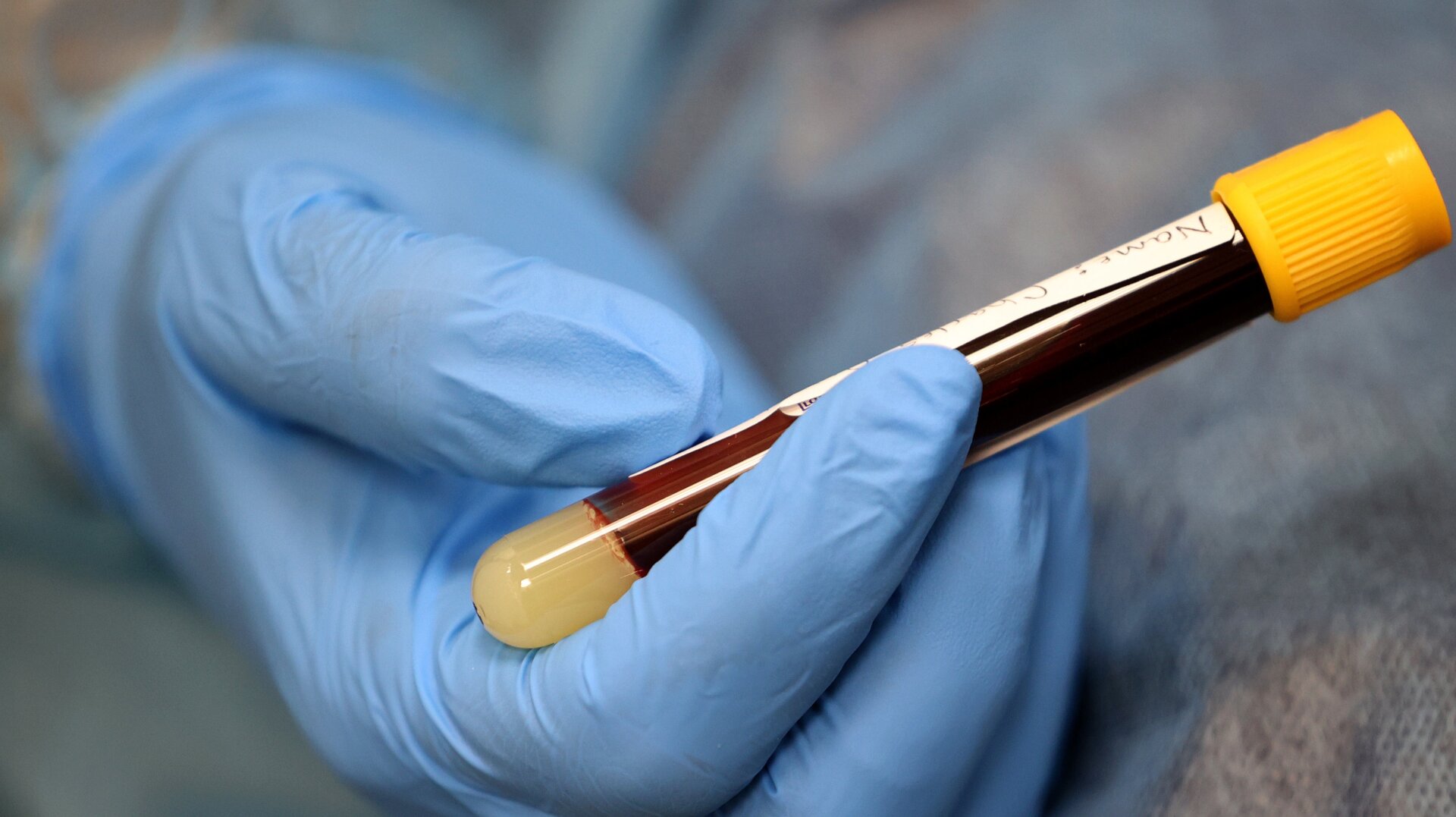 A health care worker in Washington D.C. holding up a blood sample collected to test for antibodies to the SARS-CoV-2.