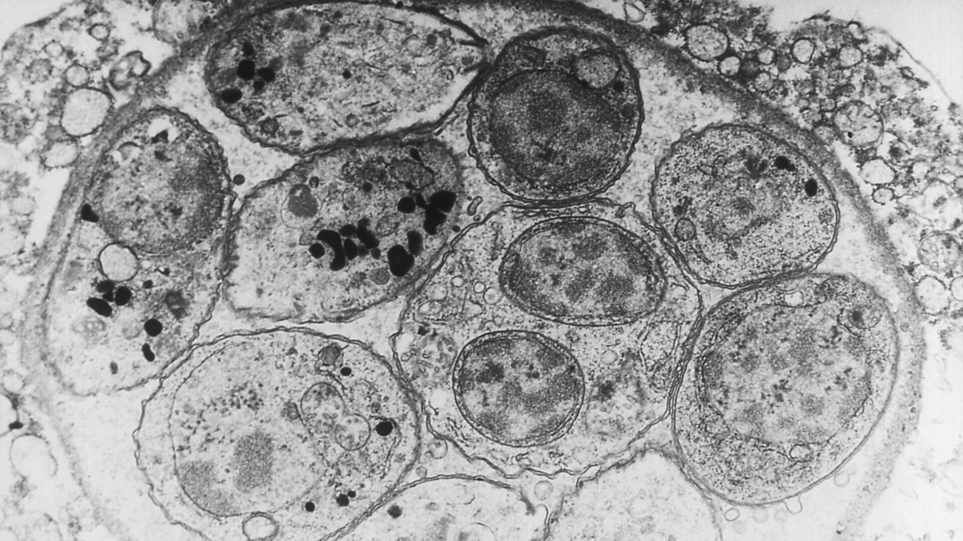 A close-up look at a tissue cyst of T. gondii under a microscope