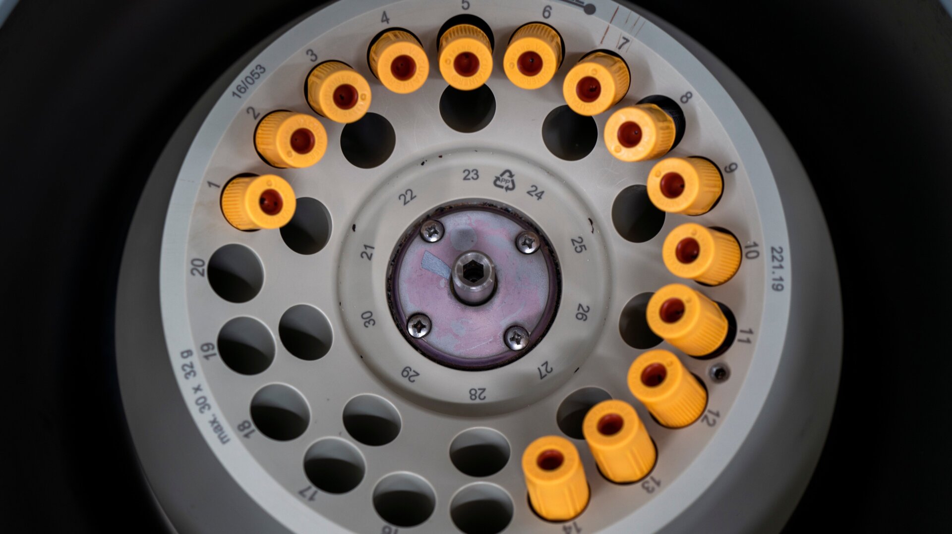A photo of blood samples being studied in one of Johnson & Johnson’s vaccine trials in Elandsdoorn, South Africa.