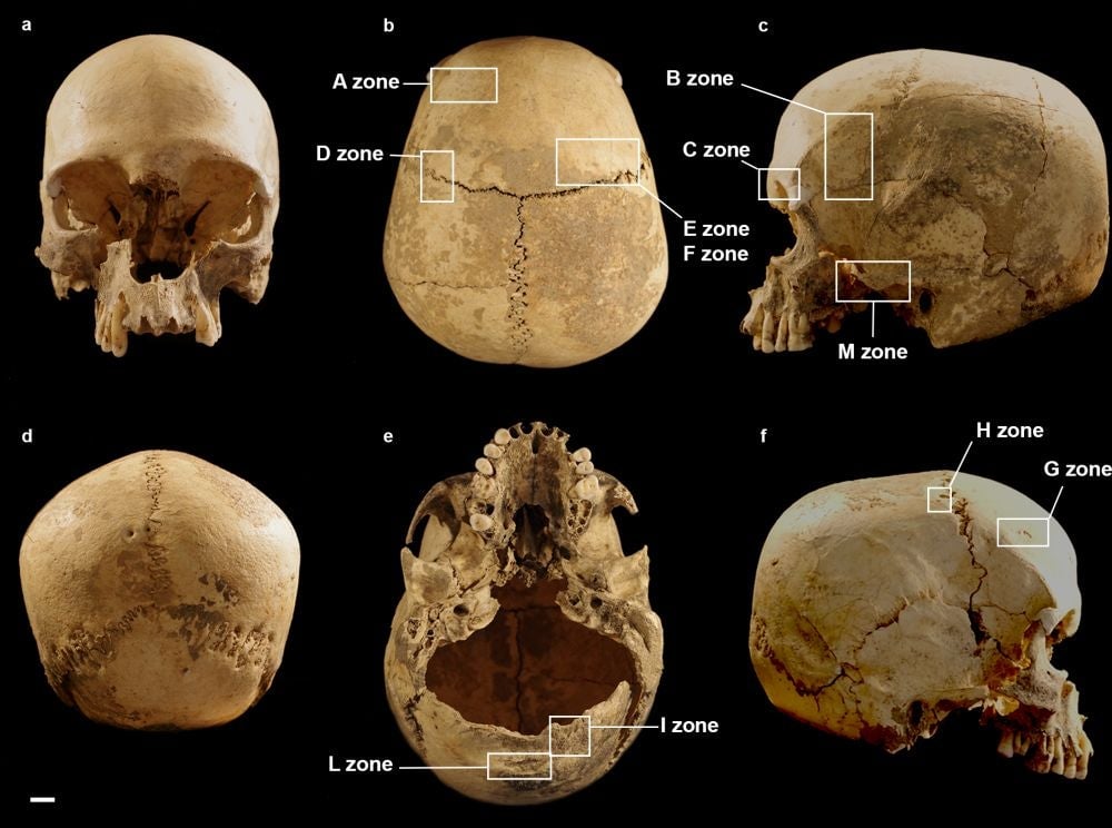 Multiple view of the cranium.