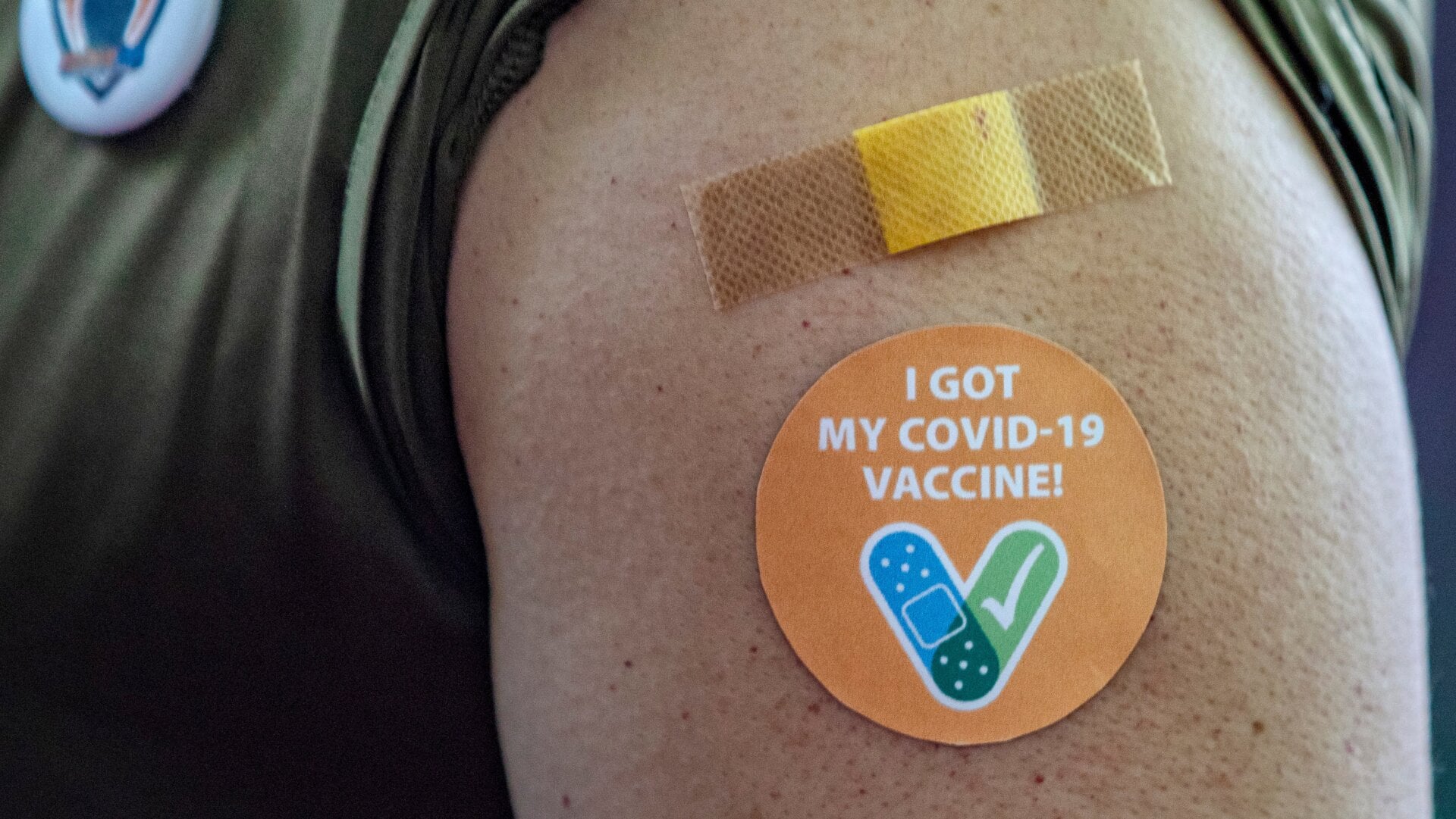 Not actually my arm.