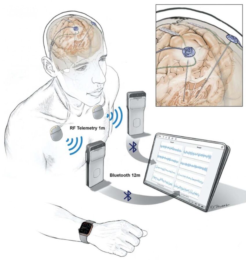 In a First, People Had Their Brain Activity Tracked Remotely During ...