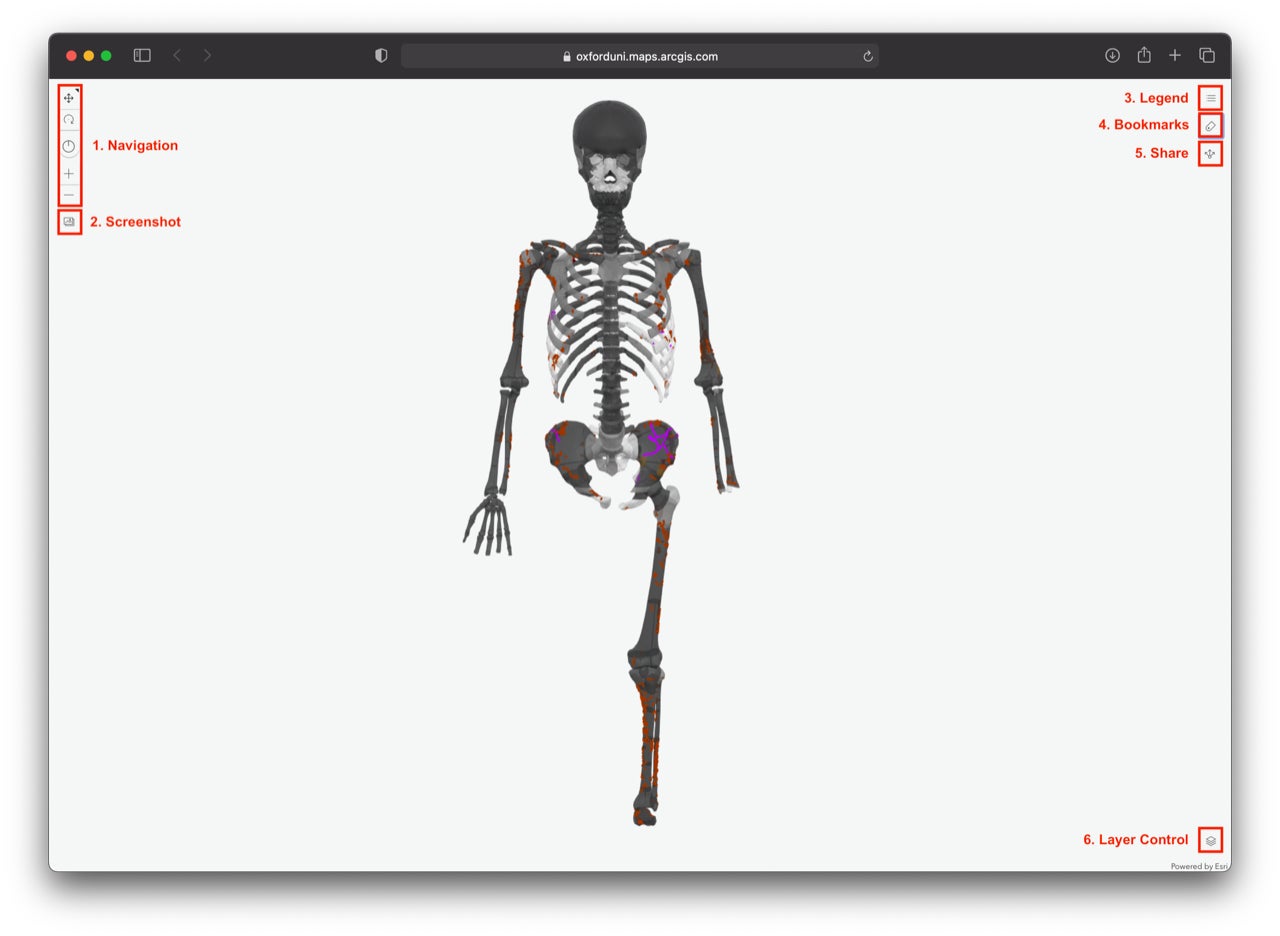 Screenshot of the Tsukumo 24 BodyMap 3D web app showing the distribution of wounds. The app was developed by John Pouncett, Rick J. Schulting, and J. Alyssa White using a modified version of the BodyParts3D model.