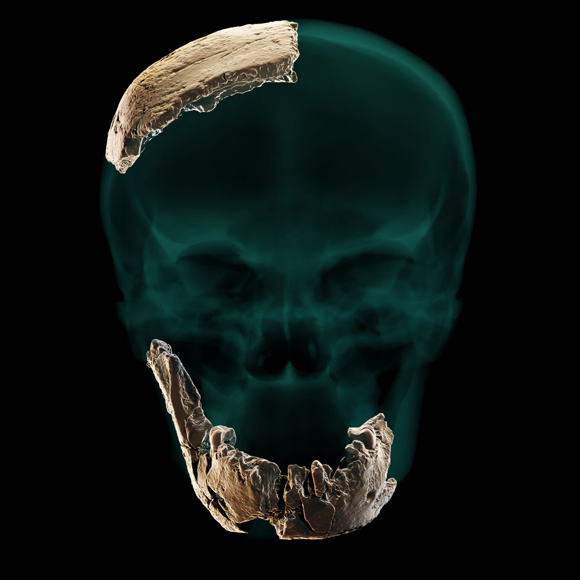 The bone fragments superimposed on a reconstructed skull.