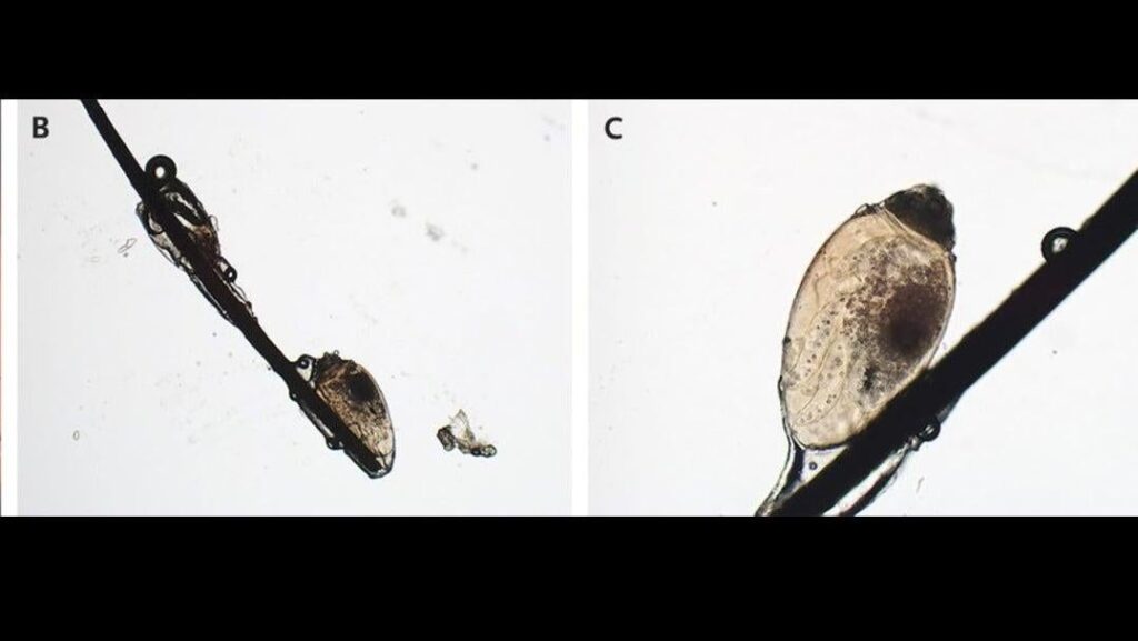 Image: Xue Feng and Hong Qi/© The New England Journal of Medicine (2021)