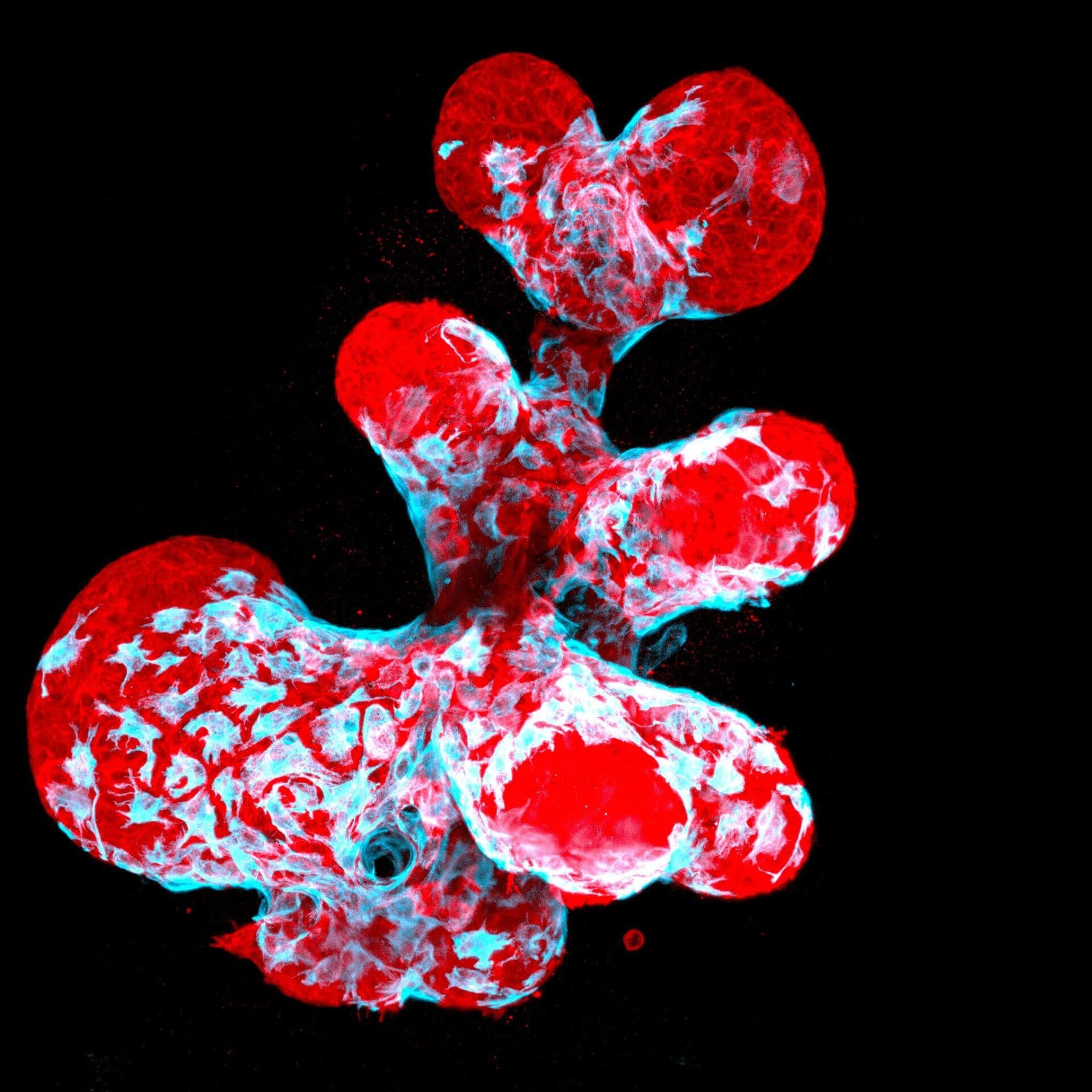 Breast organoid at 40-times resolution. 