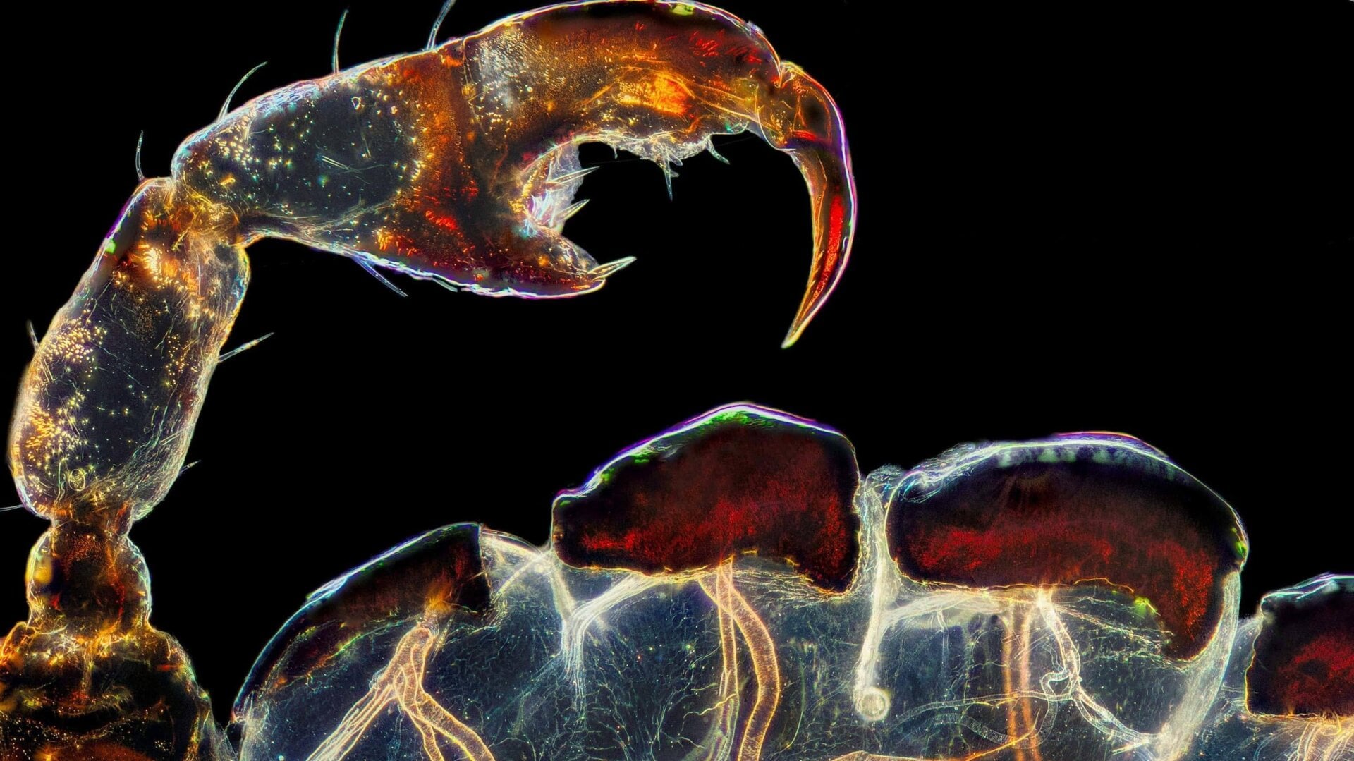 A close-up view of a louse’s claw.