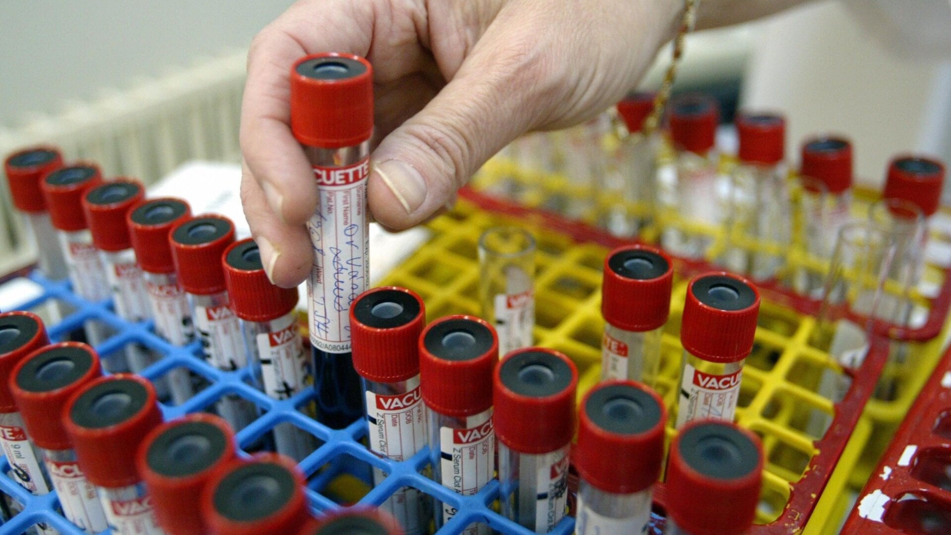 Samples being prepared for a blood test.