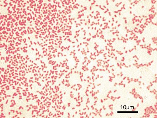 Red-stained P. aeruginosa bacteria under a microscope.