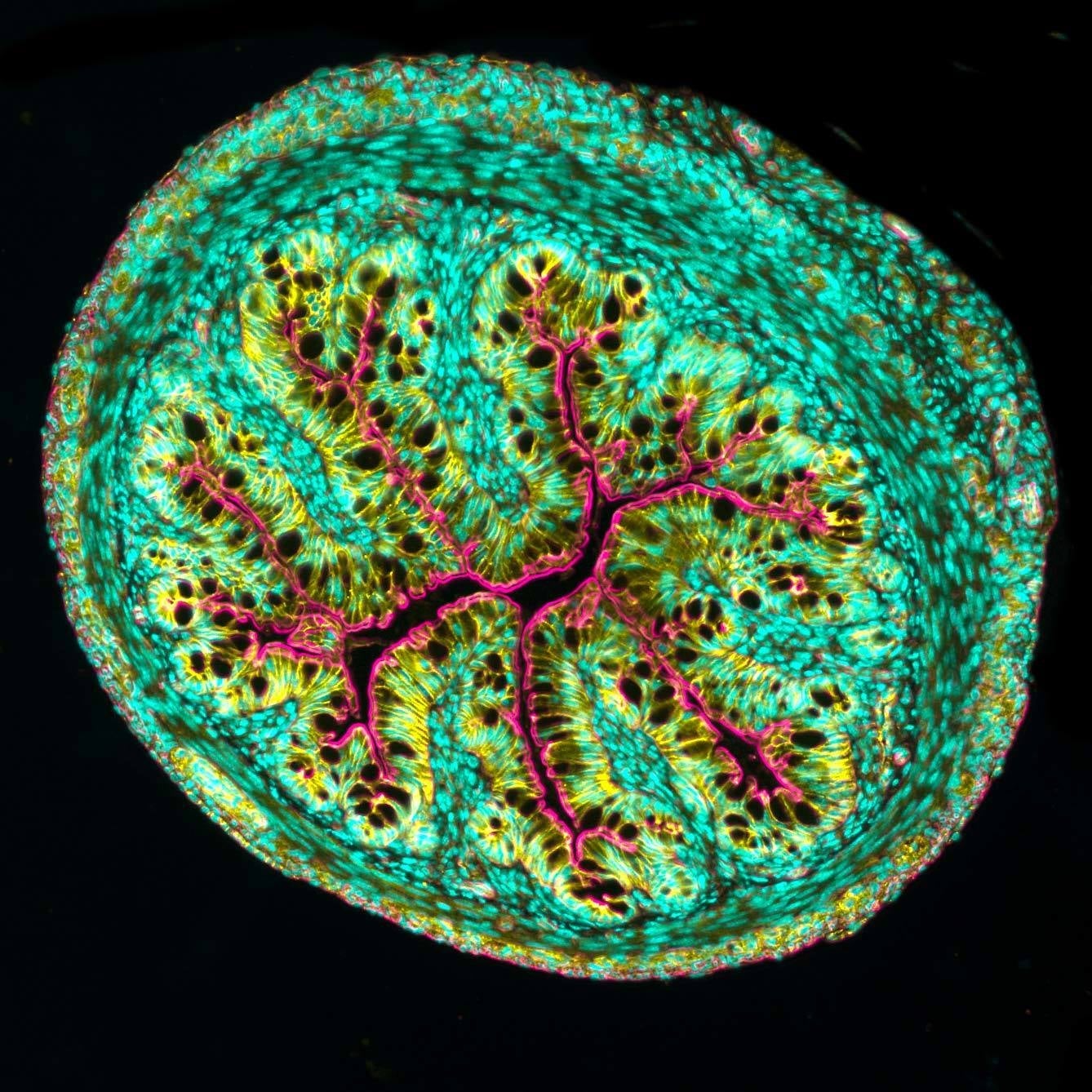 Cross section of a mouse intestine, shown at 10-times magnification. 