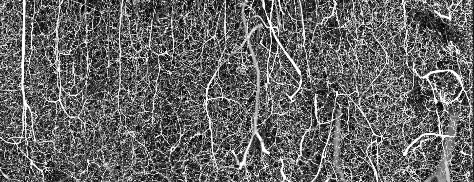 3D vasculature of an adult mouse brain.