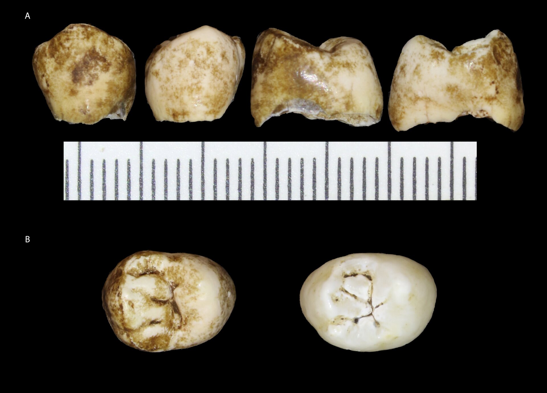 Multiple views of a molar belonging to the skull. 