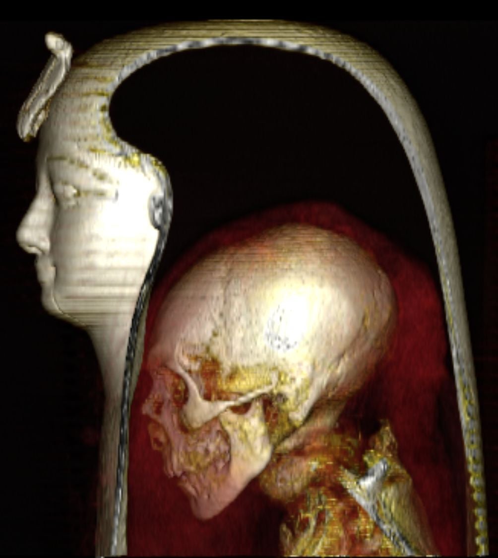 A CT scan of Amenhotep I’s body inside its wrappings.