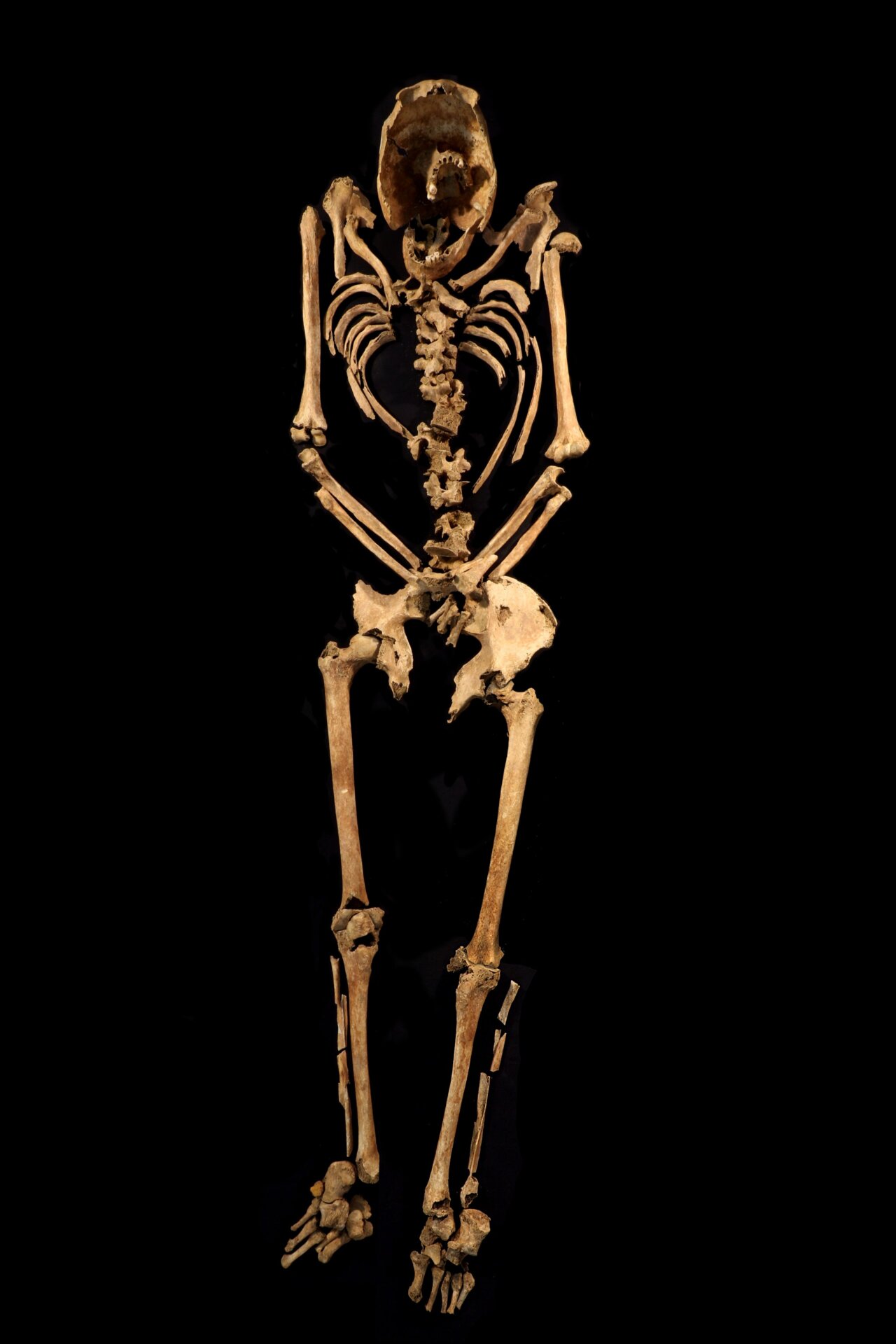 The full skeleton of the crucified man.