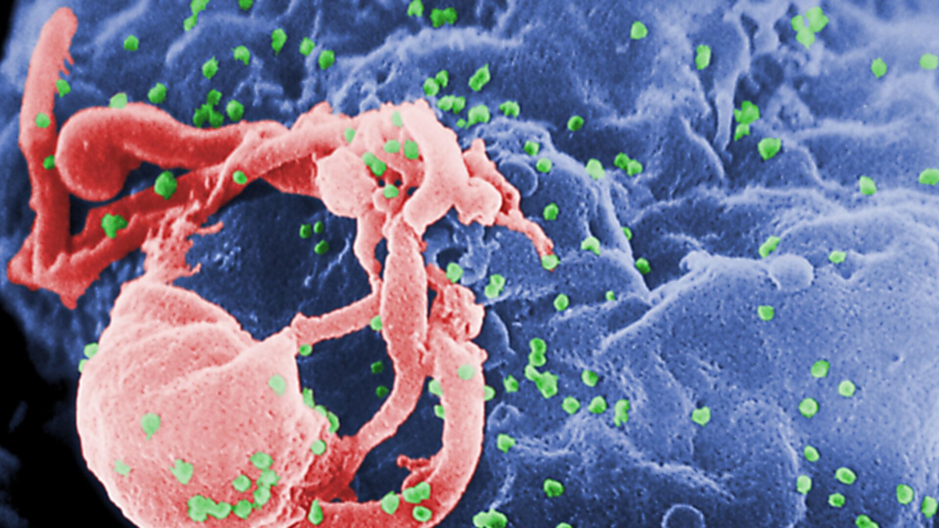 A scanning electron micrograph (SEM) of HIV-1 virions as green round bumps